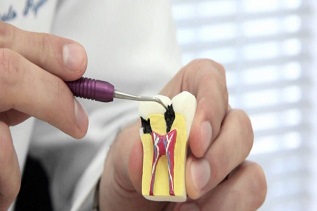 Curso de Especialização em Endodontia