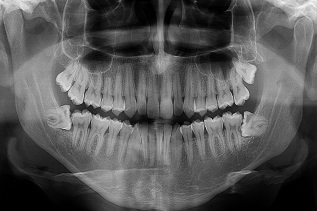 Curso de Especialização em Radiologia